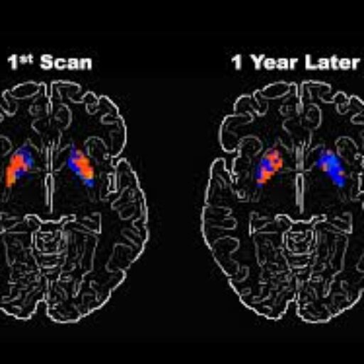 My MRI Story